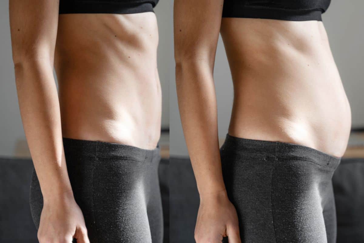 How long does diastasis recti take to improve Mortlake?