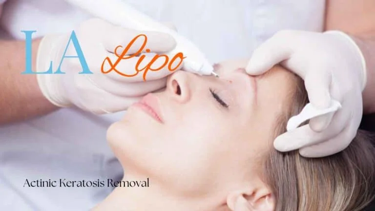 Woman receiving Actinic Keratosis Removal Treatment Mortlake