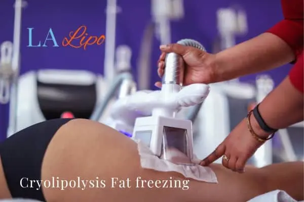 women getting fat freezing Mortlake