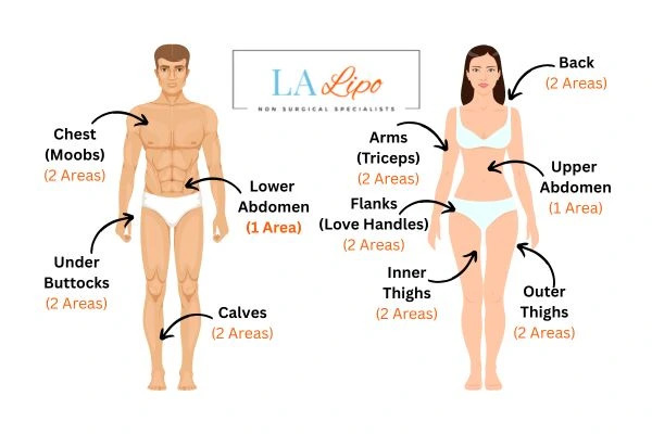 LA LIPO Cryolipolysis Areas Mortlake
