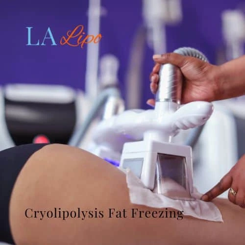 fat freezing - Cryolipolysis Mortlake