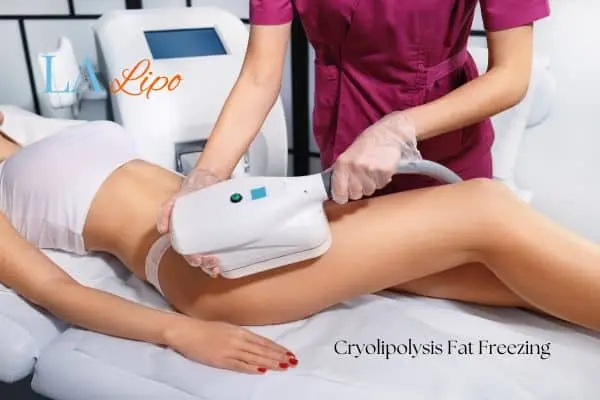 Woman receiving coolsculpting Mortlake treatment on her thighs