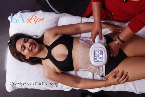 woman getting cryolipolysis Mortlake