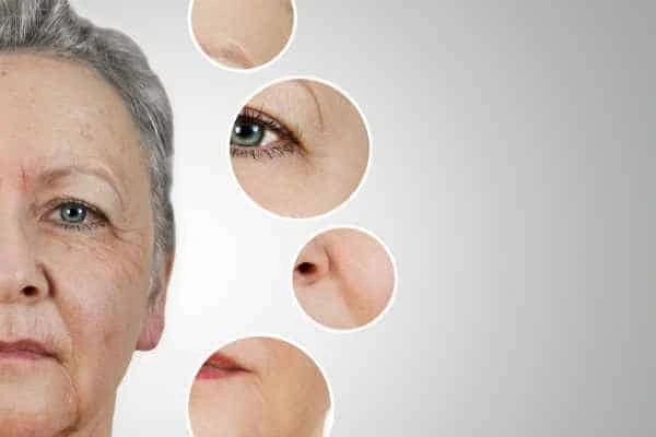 HIFU Facelift Mortlake from LA LIPO