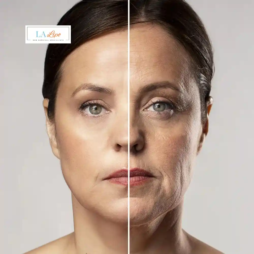 How Can You Tell If Non-Surgical Skin Tightening Is Right for You Mortlake?