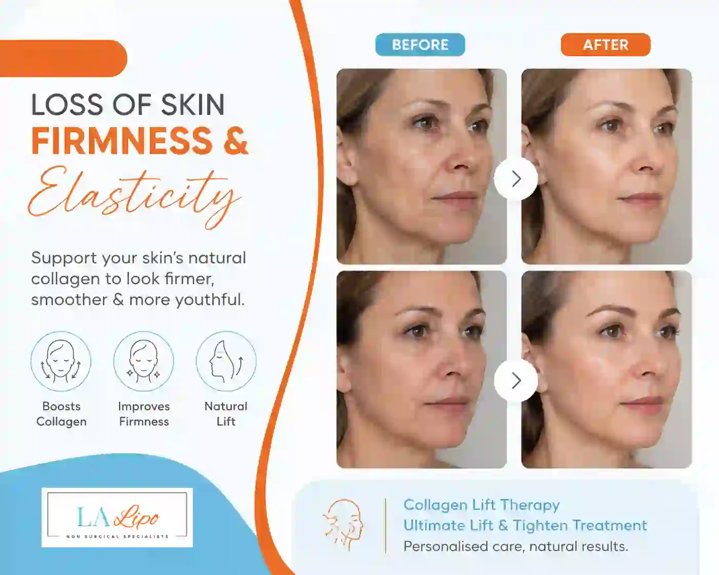 Sign #7: Loss of Skin Firmness and Elasticity Mortlake
