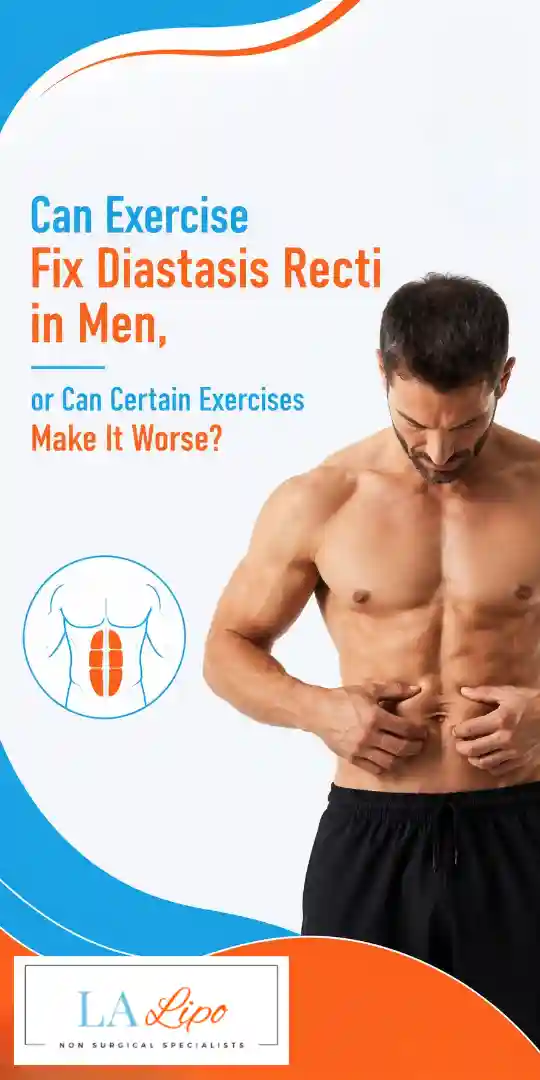 Can Exercise Fix Diastasis Recti in Men, or Can Certain Exercises Make It Worse Mortlake?